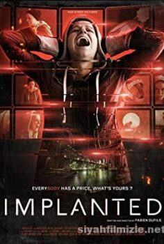 Implanted